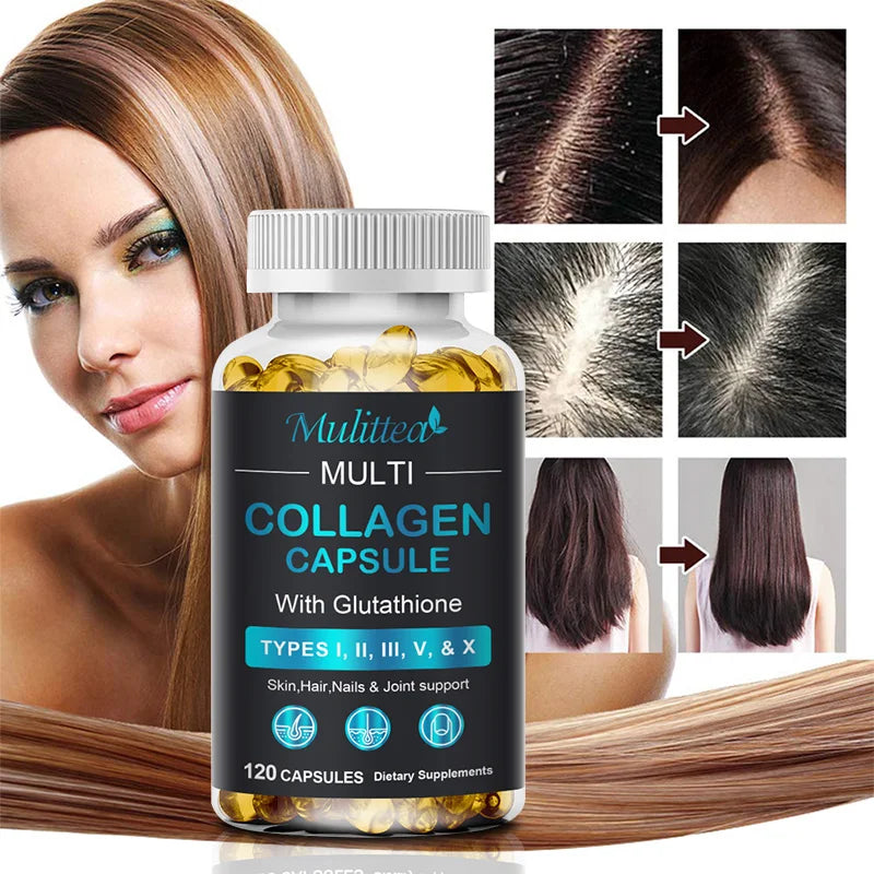 Multi Collagen with Biotin Capsules – Anti-Aging Skin, Hair, Nails & Joint Support Supplement | Firming & Glow Boost Formula (60-count)